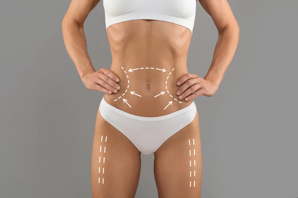 medelina health lipoliza