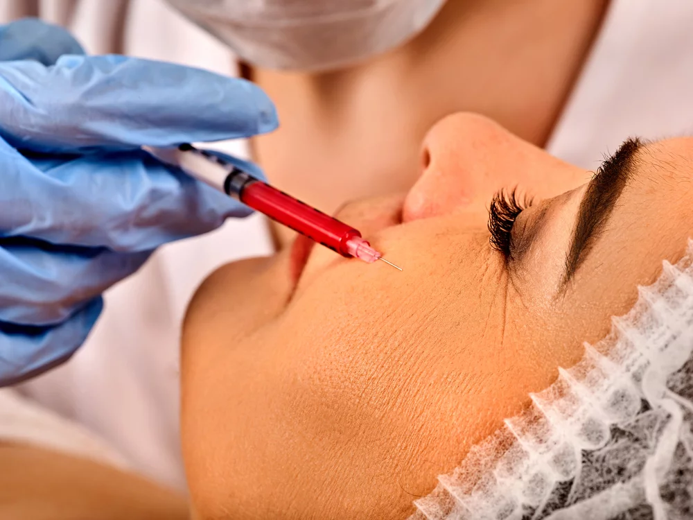Umreženi hijaluron Zagreb | Vraćanje volumena medelina health umrezeni hyaluron